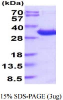 Novus Biologicals&trade;&nbsp;Human 14-3-3 epsilon Recombinant Protein
